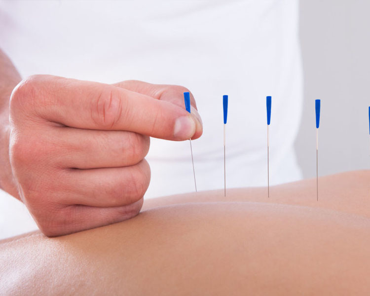 acupuntura en alicante fisioetxea fisioterapia osteopatia drenaje linfático